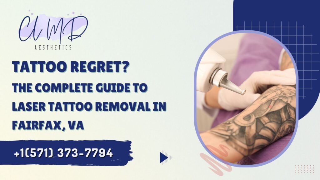The Complete Guide to Laser Tattoo Removal in Fairfax, VA