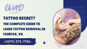 The Complete Guide to Laser Tattoo Removal in Fairfax, VA